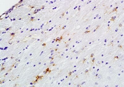 Phospho-PEA15 (Ser104) Rabbit Polyclonal Antibody